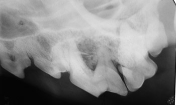 dental xray